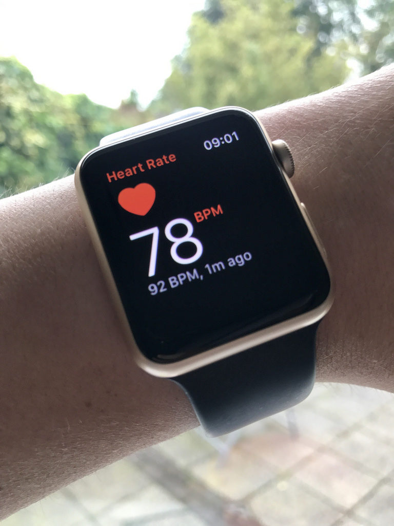 Suffer from atrial fibrillation? Your Apple watch may help.