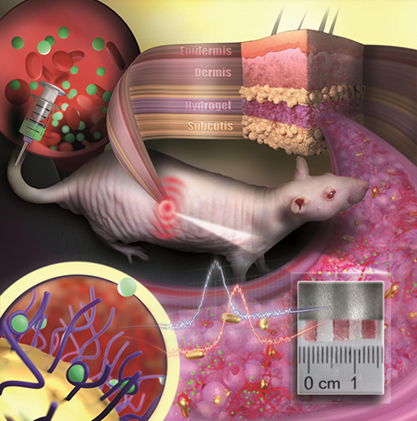 New nanoparticles may offer long-term monitoring from within the body.